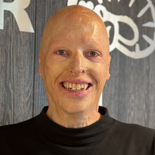 Lou Snoek